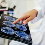 Nanovehículos de la UNAM: Innovadora tecnología para transportar medicamentos al cerebro y luchar contra el cáncer y otras enfermedades