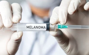 Revolucionaria vacuna experimental reduce el riesgo de recaída en pacientes con melanoma en un 40%